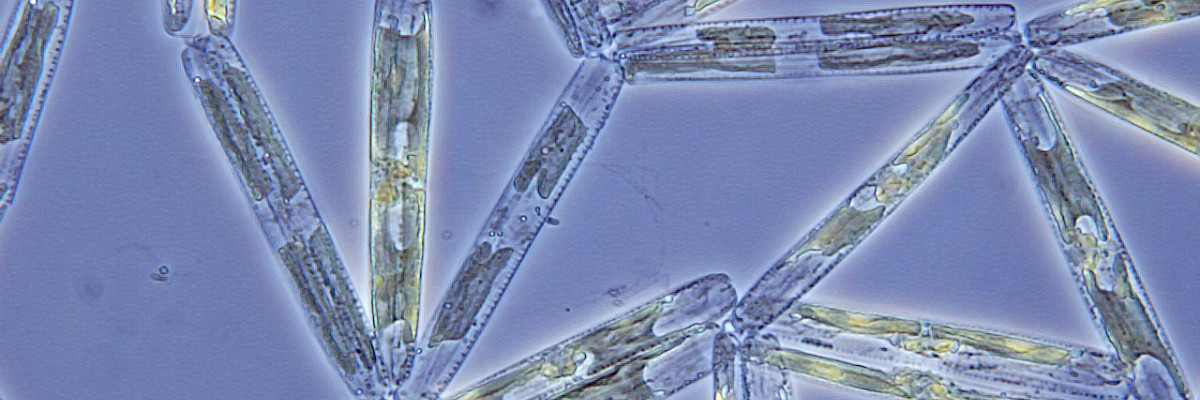 Diatom: nitzschia frigida